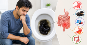 इंदौर में मल में खून आने का उपचार
